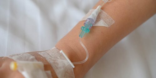 Patient's hand with Total Parenteral Nutrition (TPN) being administered into vein